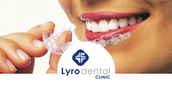 Lyrodental